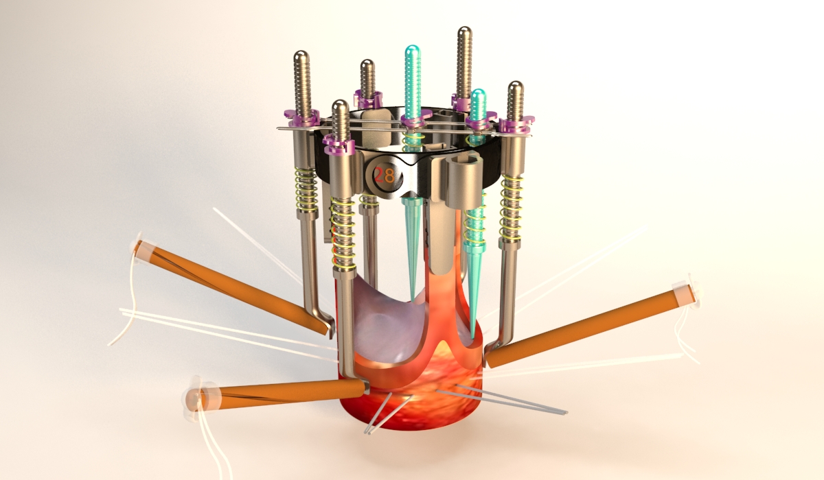 EDF device: assembly context